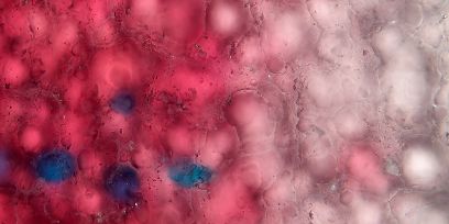 Mikroskop-Aufnahme des Unterloxaldruck-Verfahrens, Farbverlauf von Dunkelrot zu Pink mit Strukturen und blauen Einschlüssen