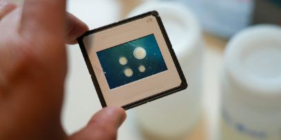 Eine Hand hält ein Bild, welches Plankton unter dem Mikroskop zeigt.